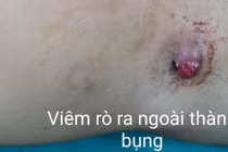 Để lâu, mảnh gỗ nằm sâu trong vùng chậu