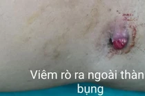 Để lâu, mảnh gỗ nằm sâu trong vùng chậu