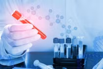 Ung thư quan trọng là xét nghiệm sớm 