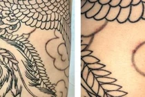 Mắc u mềm lây do xăm hình