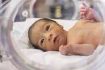 3 mức độ đẻ non