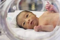 3 mức độ đẻ non