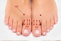 Xoa bấm ngón chân cái trị huyết áp cao