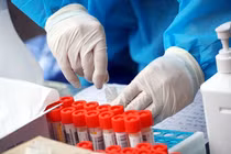 “Loạn giá” test Covid-19, trách nhiệm thuộc về ai? 