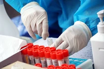  Hà Nội có 3 ca mắc mới trong một gia đình ở Hà Đông