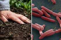 Cách phòng tránh bệnh Whitmore