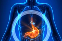 Liệt dạ dày do biến chứng đái tháo đường