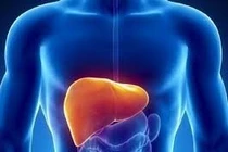 Nhìn trực tiếp hình ảnh xơ gan do rượu