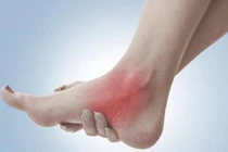 Bong gân vì vội vượt rào