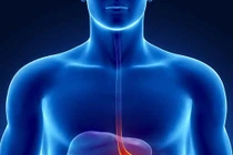 Bác sĩ Singapore “biến” ruột non thành dạ dày cho bệnh nhân ung thư