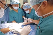 Bác sĩ ekip chỉnh hình trong ca tách song sinh Trúc Nhi - Diệu Nhi tiết lộ khoảnh khắc cuối cùng: Vừa bó bột xong là… muốn gục