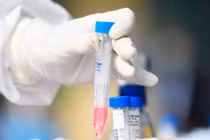 Hà Nội ghi nhận thêm một người ở Cầu Giấy nhiễm SARS-CoV-2