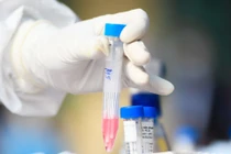 Hà Nội ghi nhận thêm một người ở Cầu Giấy nhiễm SARS-CoV-2