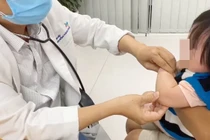 Khuỷu tay non nớt của bé dễ bị trật khi bị kéo mạnh đột ngột