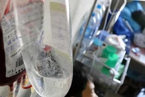 Truyền dịch - Khi nào cần?