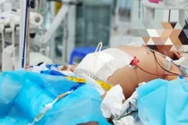 Nguyên nhân khiến nhiều ca sốt xuất huyết trở nặng 