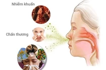 Tránh xa tác nhân gây viêm mũi