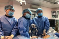 Đốt hẹp đường mật qua da bằng laser bốc hơi