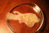 Tinh dịch màu đỏ và vàng