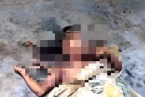 Điện thoại đang sạc phát nổ, nam thanh niên tử vong