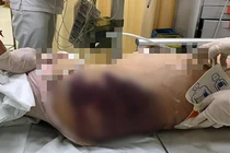 Vụ cháu bé 8 tuổi bị mẹ kế bạo hành: Mẹ đẻ ngất xỉu khi nghe tin, đau đớn nhìn con trong linh cữu