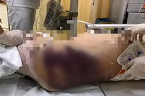 Vụ cháu bé 8 tuổi bị mẹ kế bạo hành: Mẹ đẻ ngất xỉu khi nghe tin, đau đớn nhìn con trong linh cữu