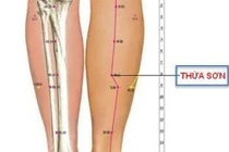Ấn huyệt thừa sơn trị chuột rút