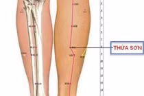Ấn huyệt thừa sơn trị chuột rút
