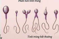 Xông hơi làm yếu "tinh binh"