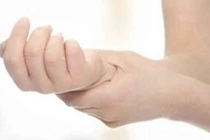 Ung thư nặng vì chủ quan với tay phù