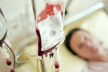 Băn khoăn khi truyền máu có quan hệ huyết thống