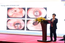 Vinmec tổ chức Hội nghị "Tiến bộ trong phẫu thuật nội soi điều trị ung thư thực quản"