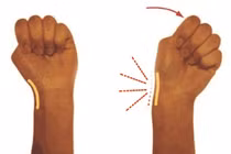 Đau vùng cổ tay trên ngón cái