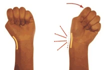 Đau vùng cổ tay trên ngón cái