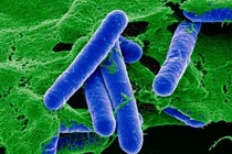 Bộ Y tế cấp phép nhập khẩu thuốc giải độc ngộ độc thực phẩm hiếm gặp