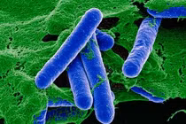 Bộ Y tế cấp phép nhập khẩu thuốc giải độc ngộ độc thực phẩm hiếm gặp