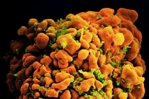 Phát hiện một biến thể HIV mới có độc lực cao ở Hà Lan