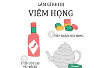 Đau họng nổi hạch lâu ngày coi chừng ung thư vòm họng