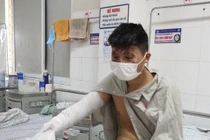 Bỏng nặng do bình gas mini phát nổ