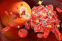 Giải pháp làm tan cục máu đông, cải thiện đột quỵ não hiệu quả từ thiên nhiên