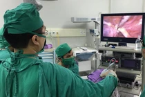 Để vòng tránh thai 30 năm đâm xuyên tử cung