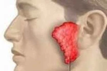 Sưng đau tinh hoàn đề nghị trữ tinh trùng