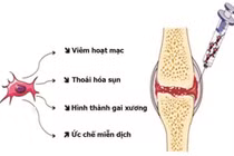 Tế bào gốc tủy xương chữa đau xương khớp
