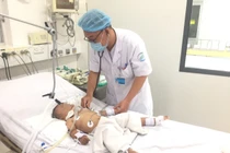 Trẻ 1 tuổi bị uốn ván từ viêm tai giữa