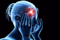 Cách ngăn ngừa đột quỵ não tái phát hiệu quả nhờ sản phẩm thiên nhiên