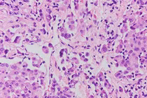 Hạn chế tiếp xúc với các vật liệu chứa amiăng