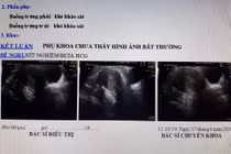 Quảng Nam: "Vác" bụng bầu đi đẻ, đến viện bác sĩ phát hiện không có thai