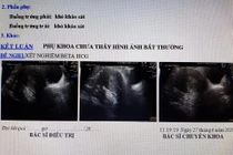 Quảng Nam: "Vác" bụng bầu đi đẻ, đến viện bác sĩ phát hiện không có thai