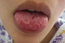 Biểu hiện bệnh qua dấu hiệu bất thường của cơ thể