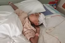 Cơ chế đột quỵ ở trẻ em